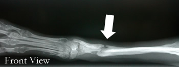 radius ulna dog